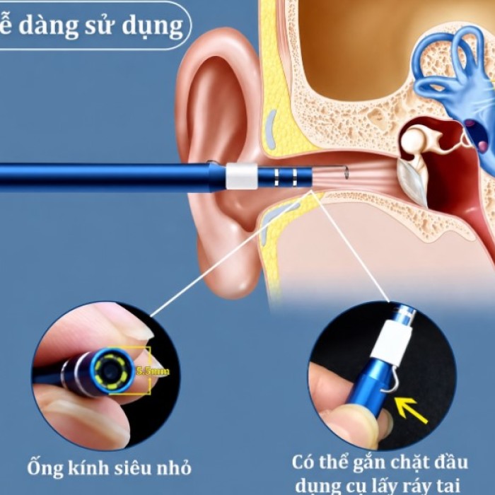 Camera Nội Soi Tai Siêu Nét 3 Trong 1 - Máy Lấy Ráy Tai Có Camera Mini Cho Điện Thoại, Chống Nước IP67 (Tặng Đầu Lấy Ráy) 
